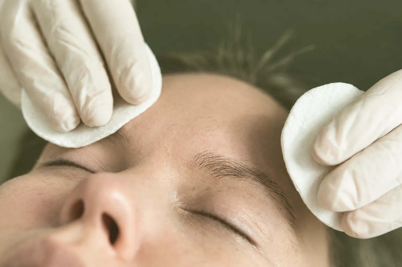 Eyebrow Transplant